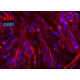 iXCellsΓäó Human iPSC-Derived Myoblasts